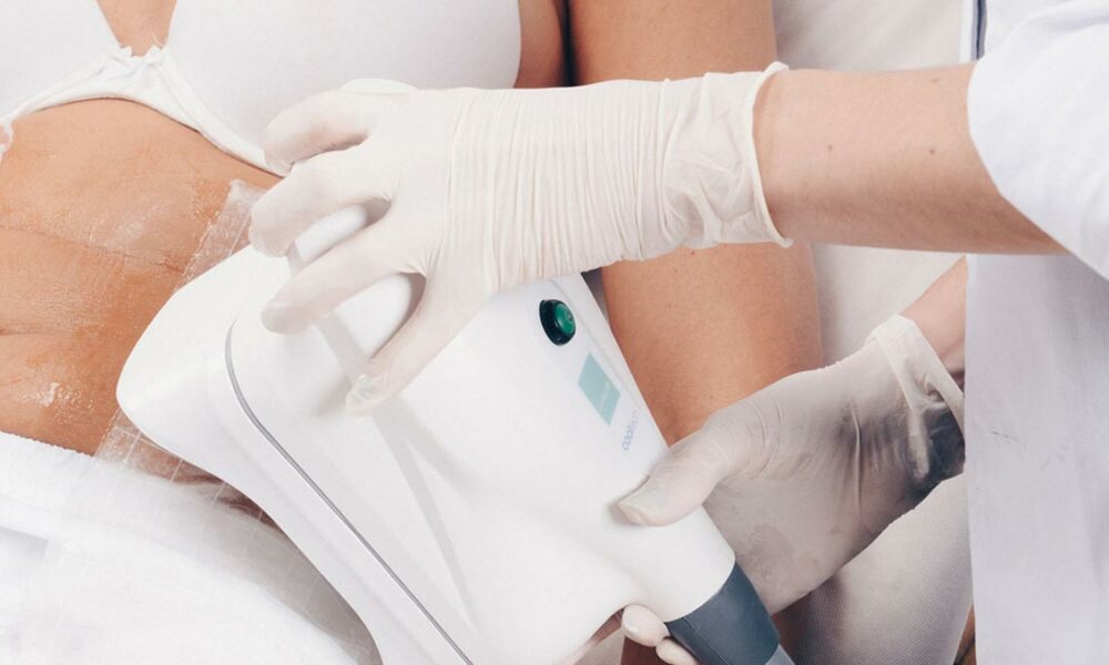 exploring-simple-and-safe-beauty-treatments:-fat-freezing-and-laser-hair-removal